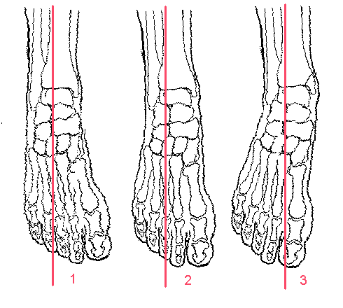 foot4